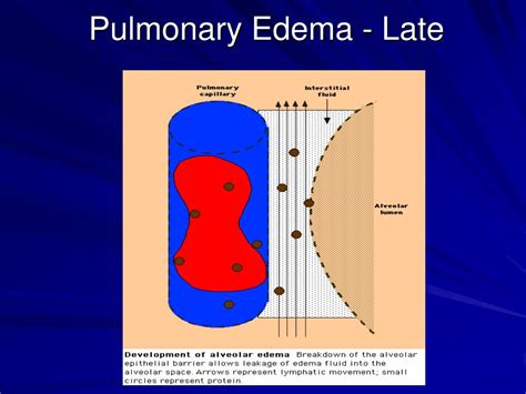 Ppt Hemodynamic Monitoring For The Respiratory Therapist Powerpoint