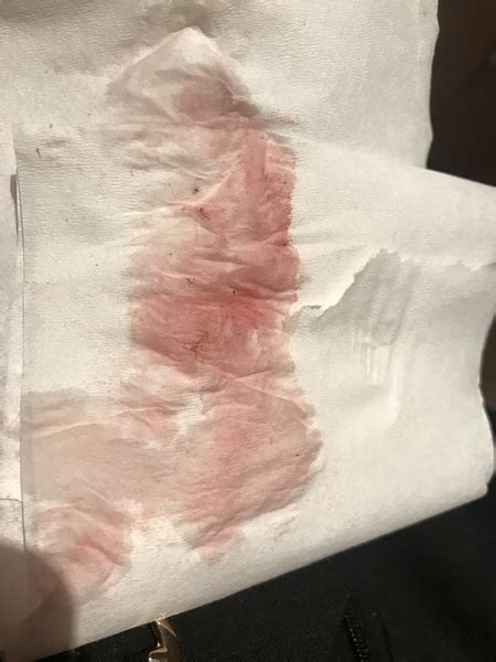 Light Pink Discharge When I Wipe 9 Weeks Pregnant