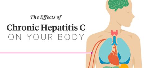 The Effects Of Hepatitis C On Your Body