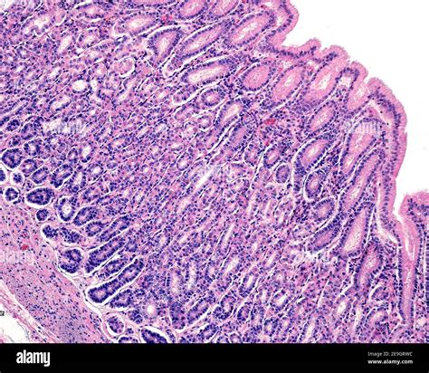Gastric Mucosa Mucosa Of A Human Stomach Showing Surface Epithelium