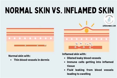 Skin Inflammation Pictures Types Causes And Treatment