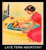 Late Term Abortion Clinics