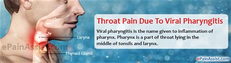 Throat Pain Due To Viral Pharyngitissymptomsinvestigationstreatment