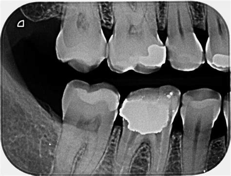 Radiografías Panorámicas En Odontología Centro Dental Parc Del Nord