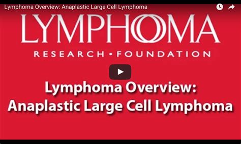 Lymphoma Overview Anaplastic Large Cell Lymphoma B Cell Non