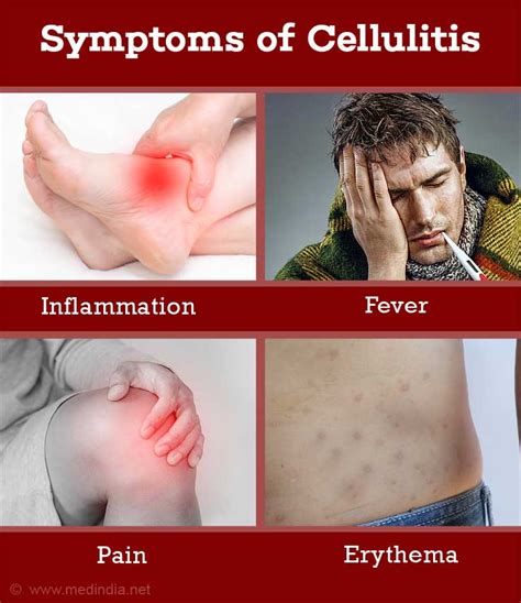 Uncomplicated cellulitis begins with a small area of skin that's red, glossy, painful, and warm to the touch, typically around a cut. Cellulitis - Causes Symptoms Diagnosis Treatment How to Avoid