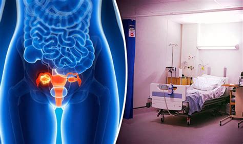 Women Dying From Ovarian Cancer Due To Lack Of Nhs Testing Says Charity Health Life And Style