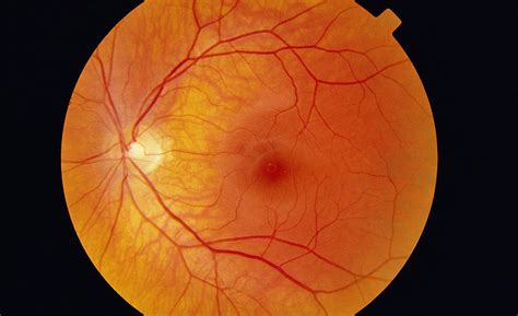 Healthy Retina Photograph By Paul Parker Fine Art America