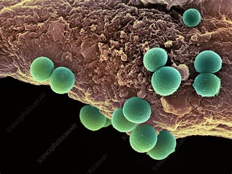 Staphylococcus Aureus Bacteria Sem Stock Image C0066698 Science