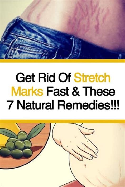 Get Rid Of Stretch Marks Fast And These 7 Natural Remedies Skin