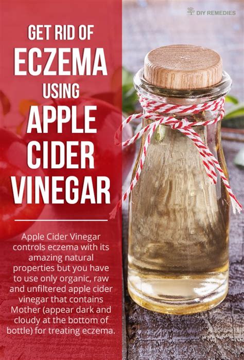 Are there any home remedies for dermatitis and eczema? How to Get Rid of Eczema using Apple Cider Vinegar