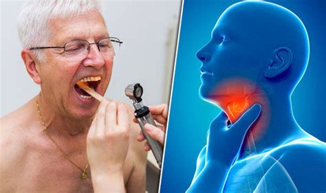 Cancer Symptoms Sore Throat Is A Sign Of This Uncommon Disease