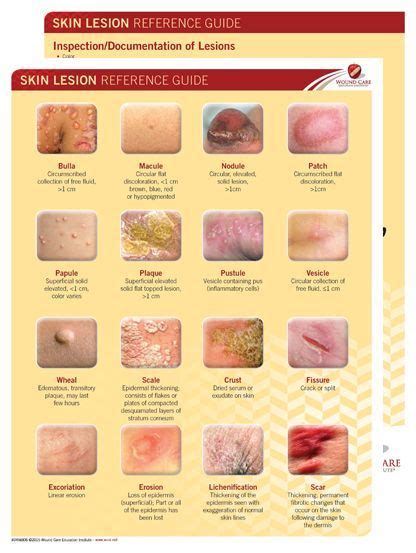 Skin Lesion Guide In 2021 Skin Care Supplies Wound Care Skin