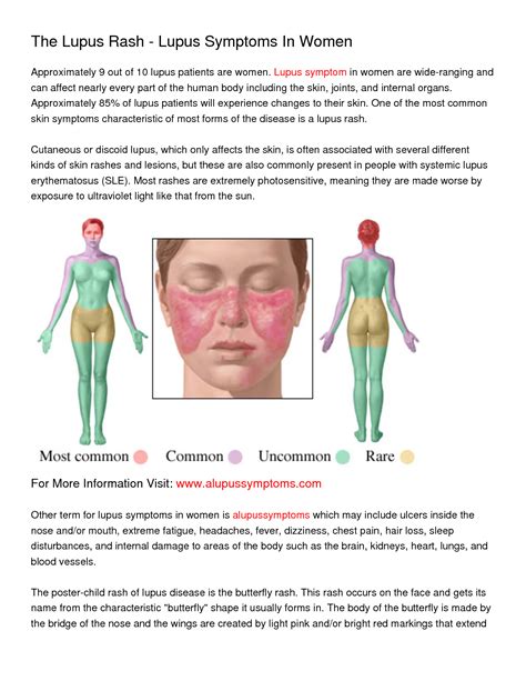 The Butterfly Rash Of Lupus Is Also Called A Malar Rash Because It