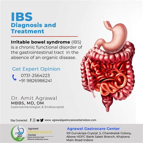 Irritable Bowel Syndrome Ibs Diagnosis And Treatment Agrawal