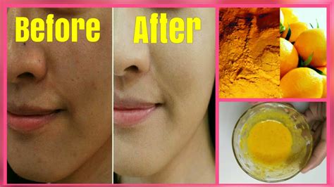 Skin Whitening Turmeric Face Mask For Instant Fair And Glowing Skinget