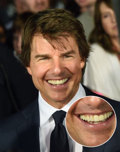 Tom Cruises Smile Is Not As Perfect As It Seems Because Of This One