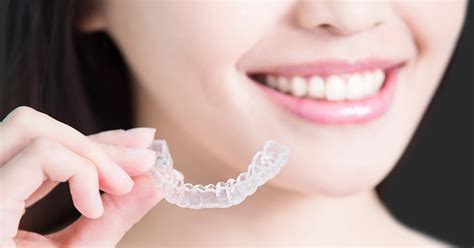 Invisalign The Clear Brace Solution For A Perfect Smile