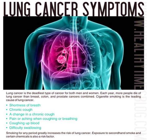 Diagram Of Over Lung Cancer Symptoms Anatomy System Human Body