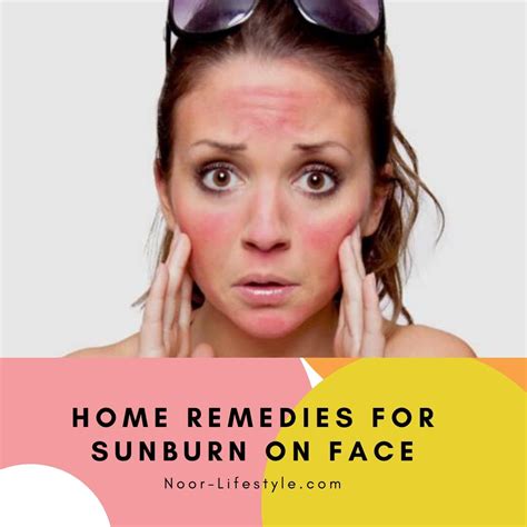 Home Remedies For Sunburn On Face