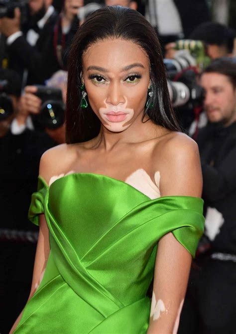 america s next top model s winnie harlow defends comments on show