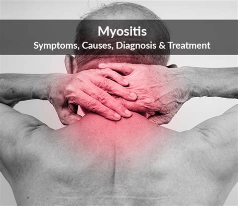 Myositis Inflammatory Myopathy Causes And Treatment