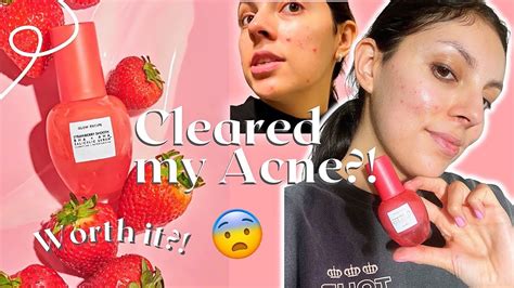 Cleared My Acne Glow Recipe Strawberry Smooth Bha Aha Salicylic