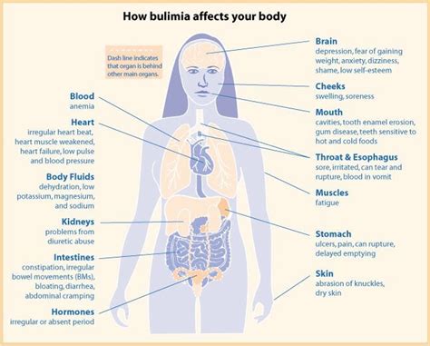 common bulimia medical complications — balance eating disorder treatment center