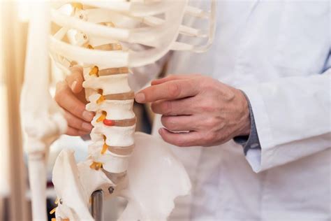 Understanding Spinal Stenosis Orthopedic And Wellness Pain Management