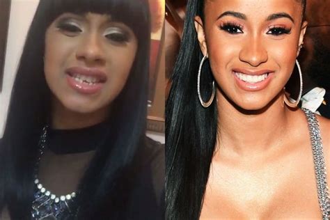 Cardi B Before Surgery Did The Rapper Really Have Plastic Surgery