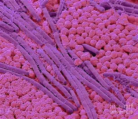 Tongue Bacteria Photograph By Steve Gschmeissnerscience Photo Library
