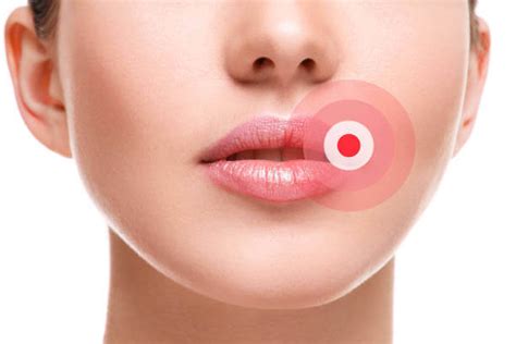 what causes sudden swelling of the lower lip