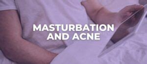 Does Masturbation Cause Acne An Esthetician Explains