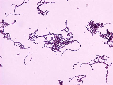 Sputum gram stain and culture. Staphylococcus saprophyticus - Microbiology - Medbullets ...