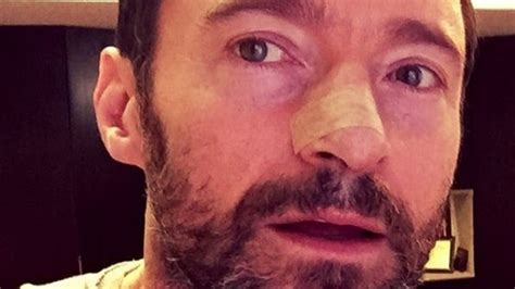 Hugh Jackman Urges Sunscreen Use After Having Fifth Skin Cancer Removed