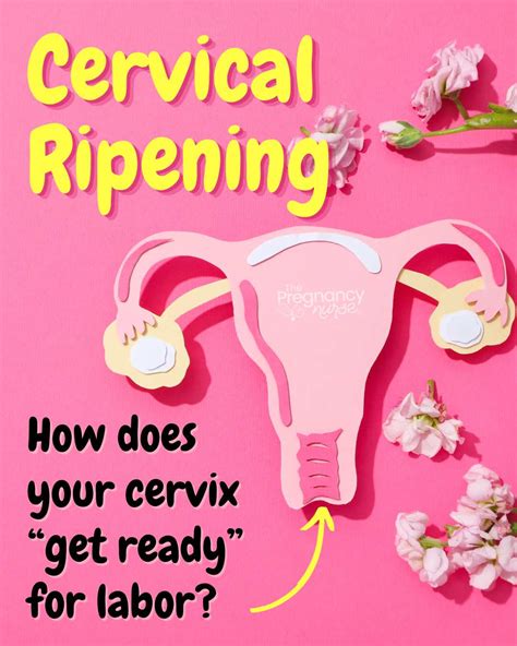 what is cervical ripening the pregnancy nurse®