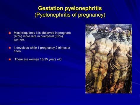 Urinary tract drainage for pyelonephritis in pregnancy (pip) is a topic that is rarely covered in the literature. PPT - ACUTE PYELONEPHRITIS PowerPoint Presentation - ID ...