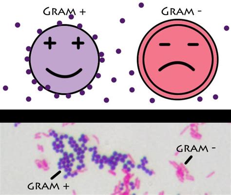 The Trick To Remembering The Difference Between Gram Positive And Gram Negative Bacteria Is To