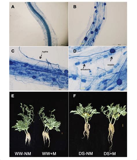 The Development Of The Arbuscular Mycorrhizal Am Fungus In