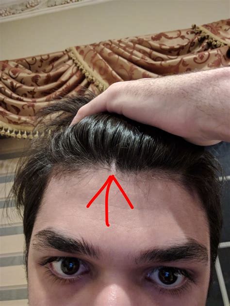 What Can I Use To Hidecover This Weird Line Of Zero Hair Growth At The
