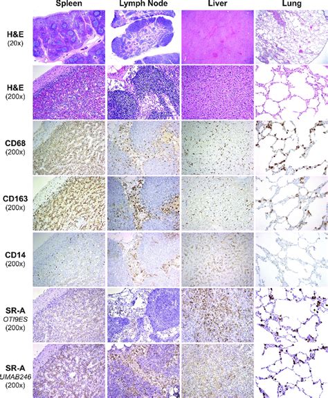 expression pattern of monocyte macrophage markers in spleen lymph download scientific diagram