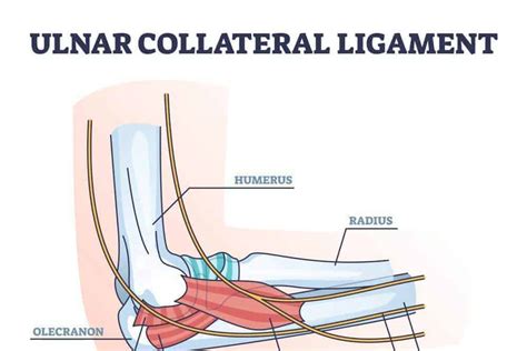 Treating A Torn Ligament In The Elbow AICA Orthopedics