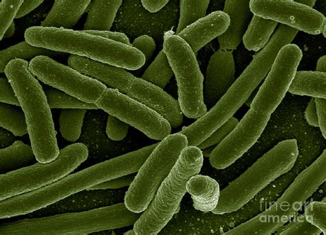 Escherichia Coli Bacteria Sem Photograph By Science Source Fine Art