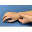 Common Causes Of Wrist Pain – Hand Therapy Group