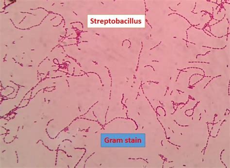 Streptobacillus Bacteria