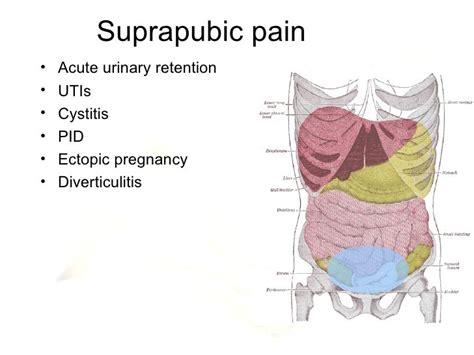 Diagnosis And Management Of Acute Abdominal Pain