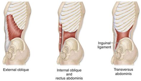 Internal Abdominal Obliques Bilaterally Trunk Flexion Compression