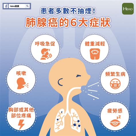 患者多數不抽煙！肺腺癌的6大症狀 蕃新聞