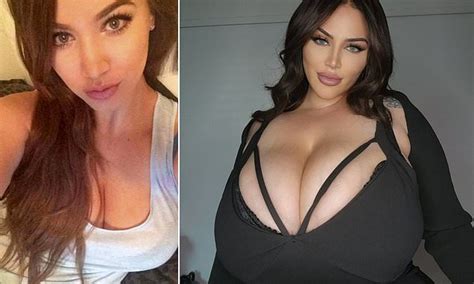 My M Sized Boobs Won T Stop Growing Because Of A Rare Condition Mail Online News Sendstory