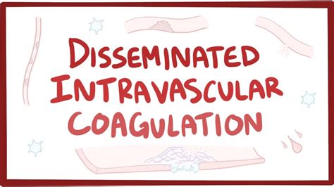 Disseminated Intravascular Coagulation Video Osmosis